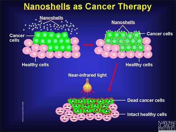Nanoshells as cancer therapy