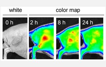 Silicon quantum dot tumor imaging